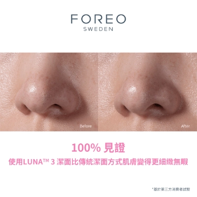 Foreo LUNA 3 head (5)